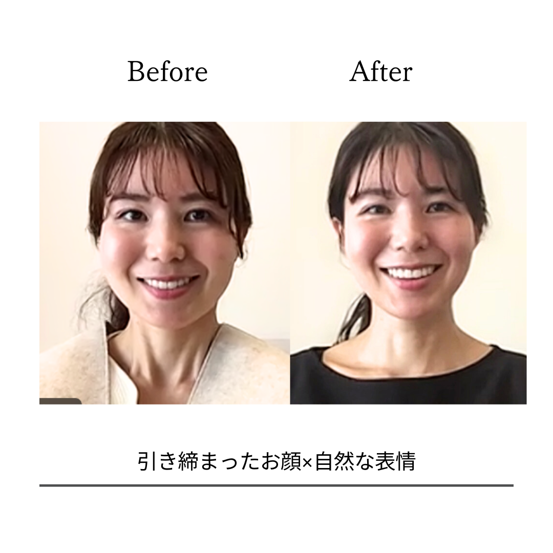 BeforeAfterPhoto